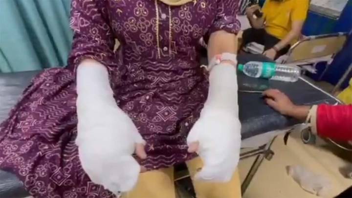 Delhi acid attack hoax: DU student used toilet cleaner; father arrested in rape case