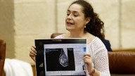 La Fiscalía de Sevilla también investiga la supuesta modificación de pruebas vinculadas al cribado del cáncer de mama