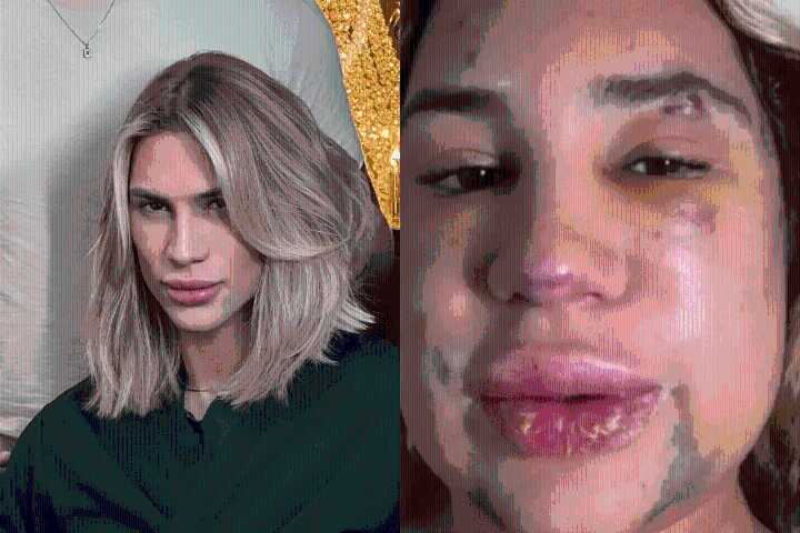 Muere influencer en Brasil tras cirugía estética en los ojos; lo habría operado un dentista