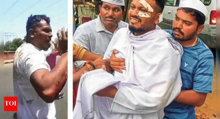 Air India 171 tragedy: The burden of being plane crash’s lone survivor