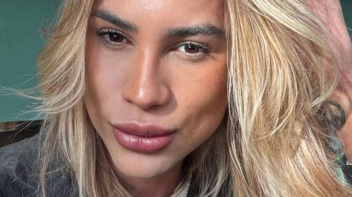 Un influencer brasileño murió luego de someterse a la cirugía estética “foxy eyes”