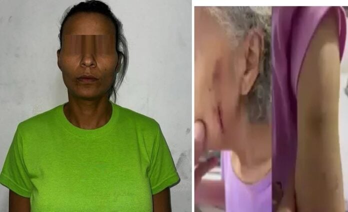 Detenida mujer por violencia física contra su suegra de 73 años en Caracas