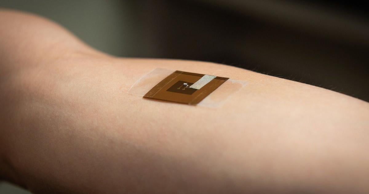 Wearable ‘smart’ patch can detect early signs of skin cancer