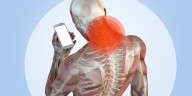Cuello tecnológico: cómo prevenir el dolor crónico al usar el celular o la computadora