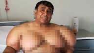 Buzo peruano vive dramática historia: lleva años “inflado” por un accidente en el mar