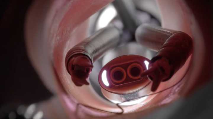 Victoria Hospitals Foundation launches $21M fundraiser for new surgical robots:  ‘Safer way to do surgery’