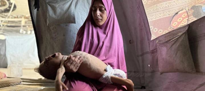 La OMS confirma 400 muertes por malnutrición en Gaza, 80 en menores de cinco años