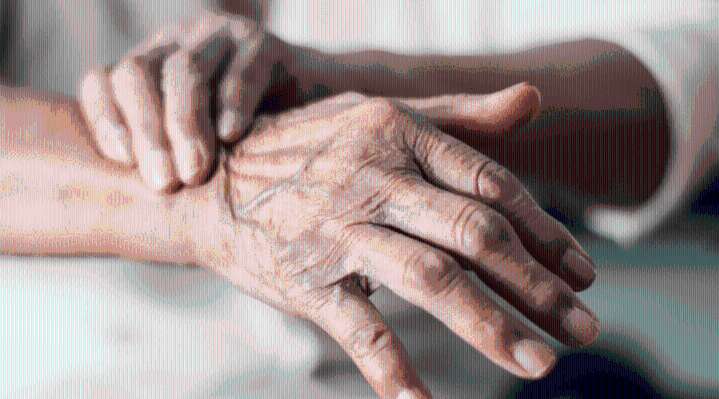 Parkinson: avances prometedores y posibles soluciones en los años venideros