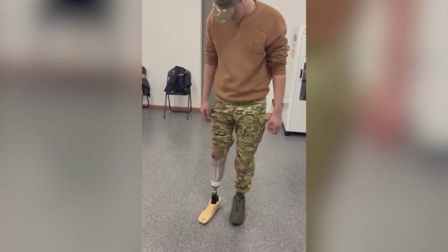 3-D printing tech from Saratoga County business creates prosthetics for Ukrainians