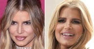 Jessica Simpson’s ‘Exaggerated' Face Fillers Explained By Plastic Surgeon
