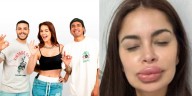 Laura Spoya sufrió terrible intoxicación y sus compañeros se burlaron de ella: se le hincharon los labios y no podía hablar