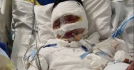 Teen 'doused in petrol and set alight' as family reveal gruesome extent of injuries