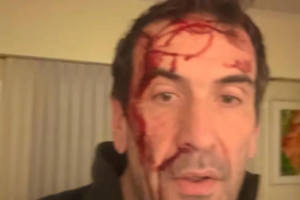 Horas antes de la elección, un candidato de LLA por Neuquén denunció ladrones entraron en su casa y lo golpearon