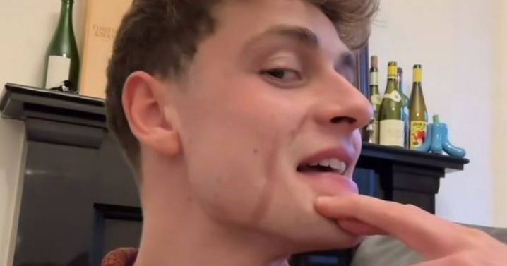 Edinburgh Bake Off champion warns 'don't be an idiot' after baking 'mishap'