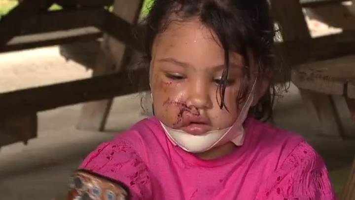 3 dogs euthanized in Mentor after child, mom attacked by one of them