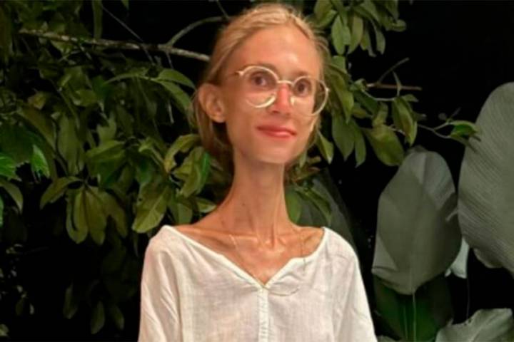 Una influencer de 27 años muere tras seguir una dieta exclusivamente de frutas: pesaba 22 kilos