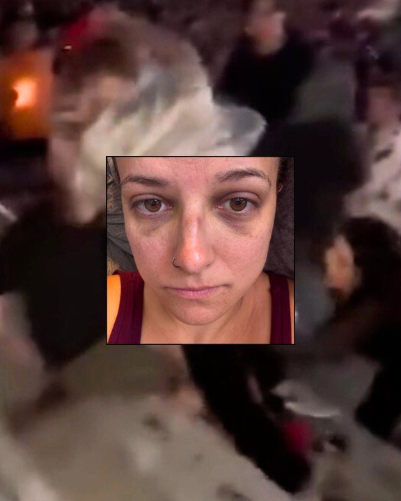 Arizona woman beaten unconscious by man at concert sues Rose Bowl