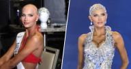 Miss USA Contestant With Alopecia Is First to Compete Without Hair