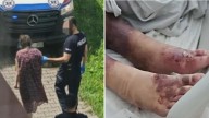 Świętochłowice: Parents allegedly keep daughter Mirella locked in room for 27 years