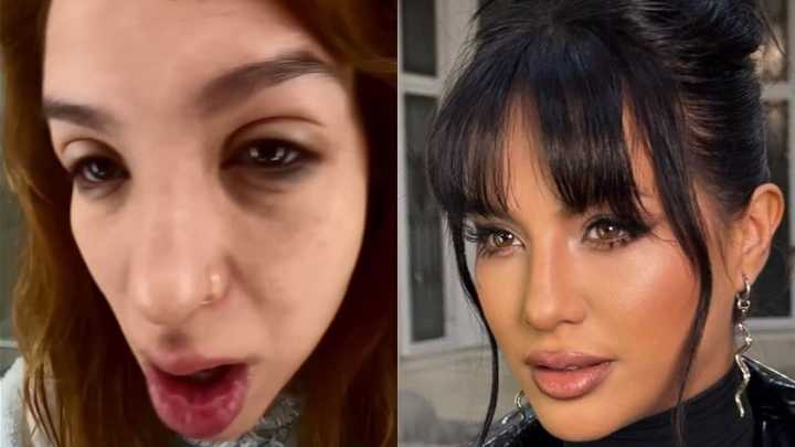 Con los ojos hinchados y angustiada: las fuertes fotos que subió Flor Vigna apuntando otra vez contra Luciano Castro