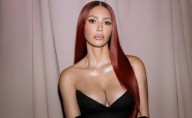Kim Kardashian revela que fue diagnosticada con un aneurisma cerebral