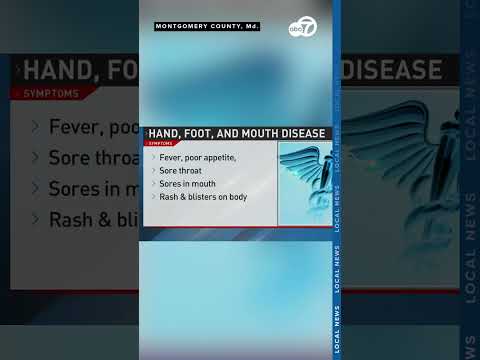 Hand, foot and mouth cases rise in Maryland schools