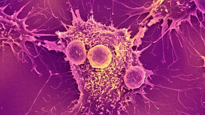 Cancer Vaccine Blocks Multiple Tumors in Mice For 250 Days