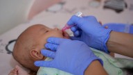 Telangana infant dies after polio drops; death likely due to asphyxia, not vaccine: Officials