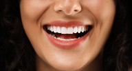 Día Mundial de la Sonrisa: 85% de adultos peruanos padece periodontitis y 90% caries dental