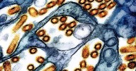 Second case of bird flu confirmed in Jefferson County