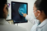 Cáncer de mama: 62 víctimas mortales al mes en 2024
