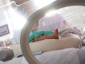 Bebé de 2 meses en Armenia necesita cirugía urgente, pero Asmet Salud no autoriza