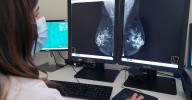 Andalucía ampliará el cribado de cáncer de mama a mujeres de entre 45 y 75 años