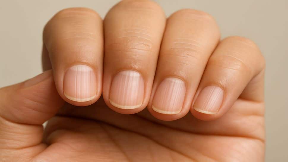 Nail Lines You’re Ignoring Could Be Life-Altering: Here’s What Your Body Is Missing