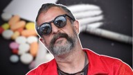 Después de los excesos: así luce Tito Fuentes de Molotov tras su primera cirugía