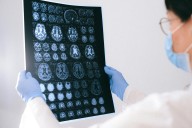Investigación busca revelar como nos volvemos ‘expertos’ en leer radiografías