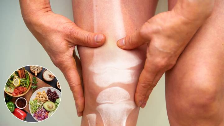 World Arthritis Day 2025: How Nutrition And Exercise Can Ease Your Joints The Smart Way
