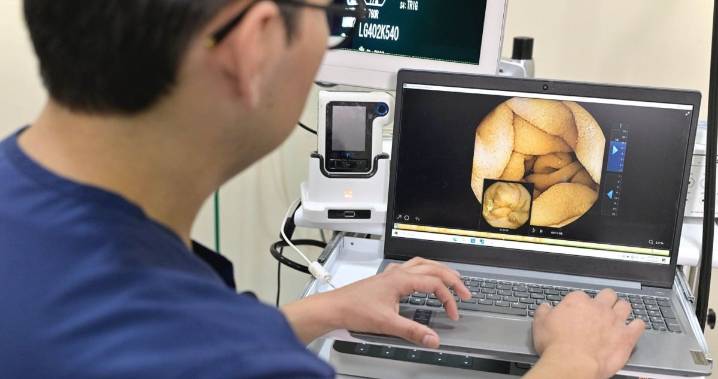 Un estudio descubre cuál es a dieta ideal contra el síndrome del intestino irritable