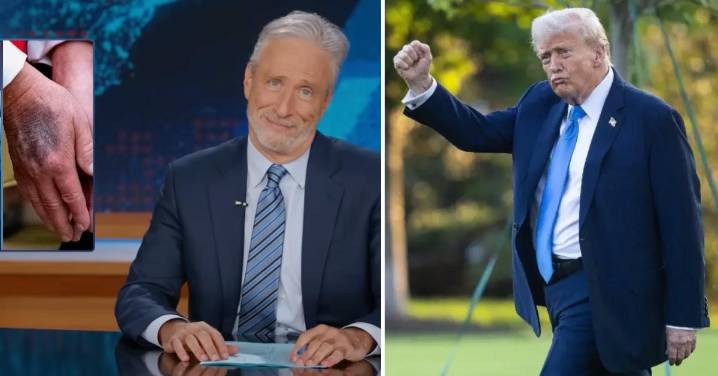 Jon Stewart Jokes Donald Trump Has the 'Broken Down, Inbred Body of a King' While Showing Photos of President's Bruised Hand: Watch