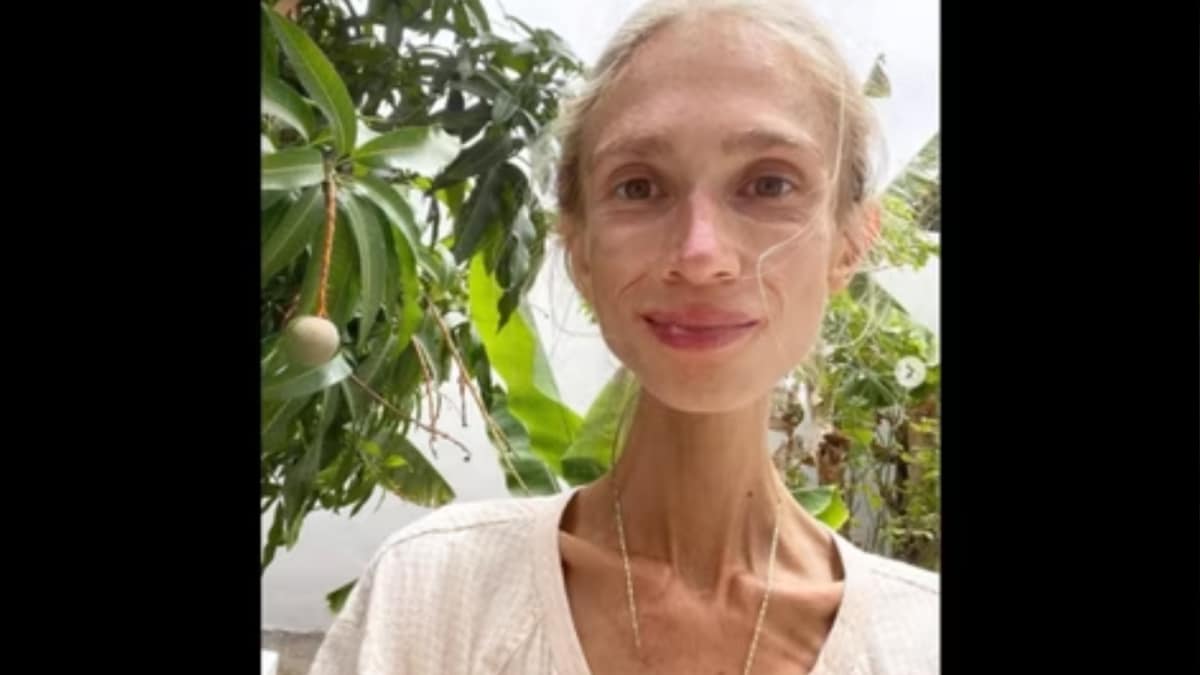 Cutting Out Protein? Woman Dies Of Starvation In Bali After Extreme Fruit