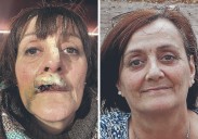 «Un perro me arrancó la boca y me está arruinando la vida»