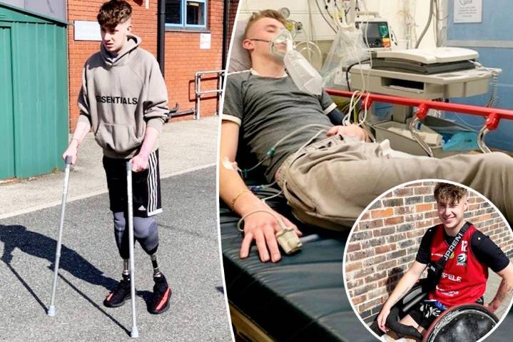 ‘Healthy’ man has both legs amputated days before 21st birthday after sepsis diagnosis