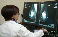Campaña de la Ssa va por 90% de detección oportuna de cáncer en mujeres