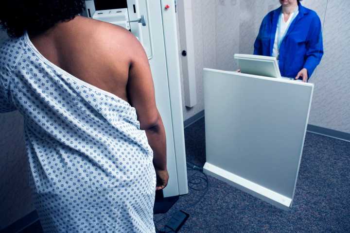 Study finds late-stage breast cancer increasing, especially among Black women