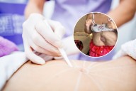 “Movilizaron mis intestinos con las manos”: la desgarradora historia de la influencer que sobrevivió sin estómago tras una cirugía estética fallida