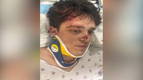 Firefighter recovering as search for hit-and-run driver continues: 'I'm blessed to be where I am'