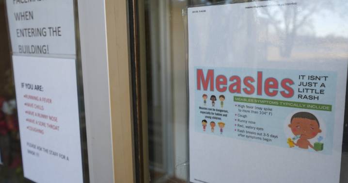 SLCo's 'likely' first case of measles detected; patient refuses to be tested