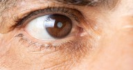 Cataract Surgery Becoming An In-Office Procedure, Experts Say