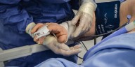 Fecoer exigió claridad al Gobierno tras bloqueo de datos y discrepancias sobre la crisis en salud: “Necesitamos transparencia en las cifras”