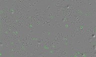 Descubren un mecanismo bacteriano que podría destruir células tumorales